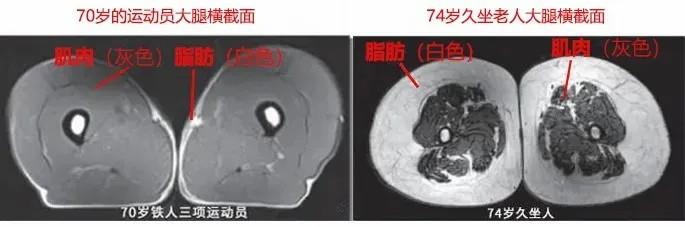 運動是加速衰老，還是延緩衰老？真相揭開