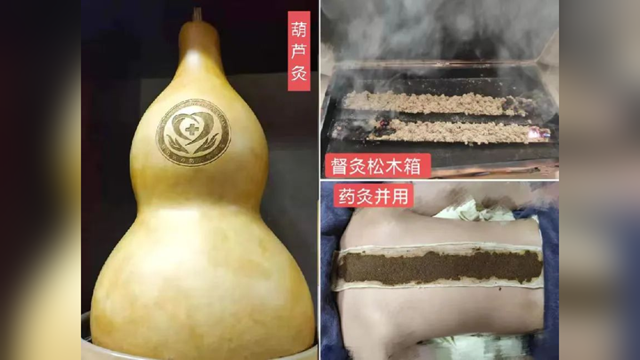 冬病夏治正當時，駐馬店市第二中醫院即將開展2025三伏貼、三伏灸服務